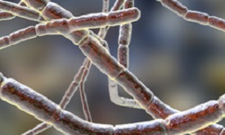 Nocardia